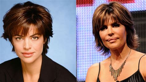 lisa rinna lips surgery.